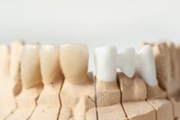 Technical,Shots,On,A,Dental,Prothetic,Laboratory